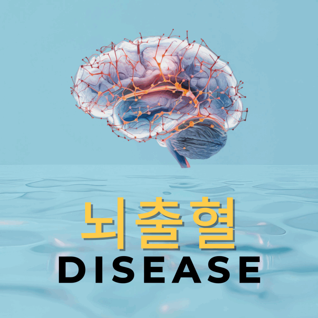 뇌출혈 초기증상 7가지와 원인·예방법 5가지, 응급처치법 4단계 총정리 요약이미지