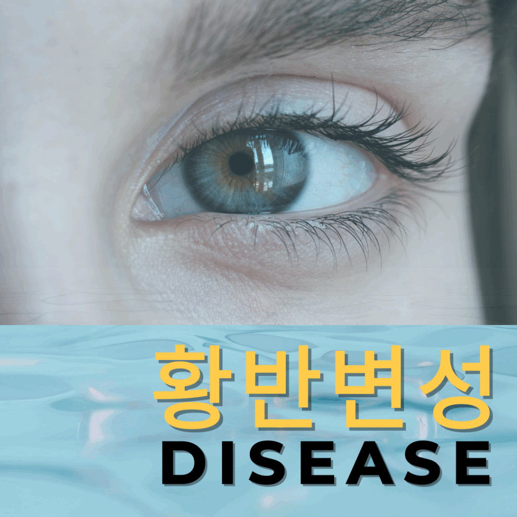 황반변성 초기증상 7가지와 종류, 예방 및 최신 치료법까지 총정리 요약이미지